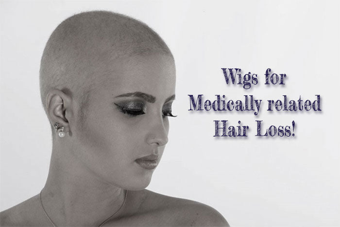 Wigs for Medically Related Hair Loss!
